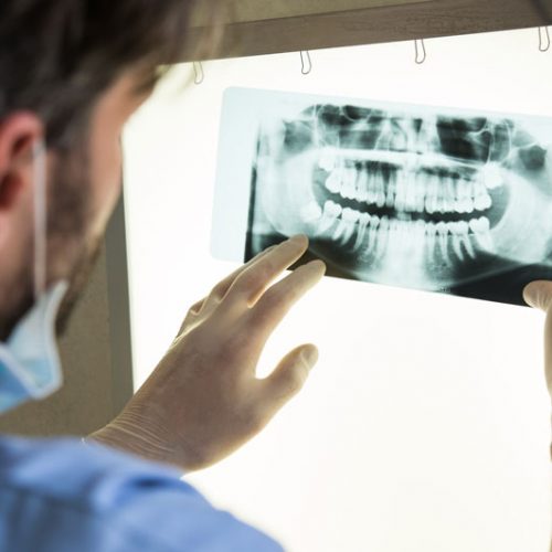 Clínica dental El Pilar tratamientos cirugía