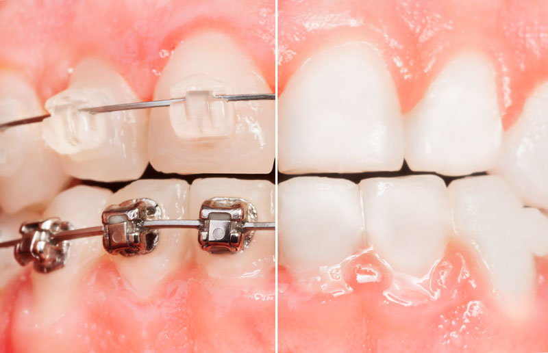 Clínica dental El Pilar tratamientos ortodoncia