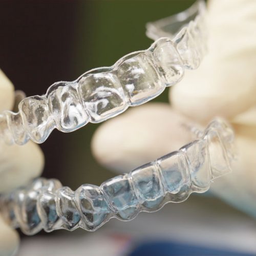 Clínica dental El Pilar tratamientos ortodoncia
