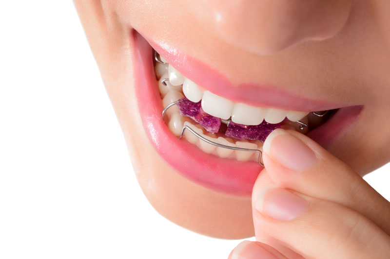 Clínica dental El Pilar tratamientos ortodoncia
