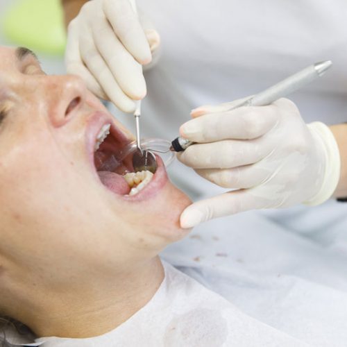 Clínica dental El Pilar tratamientos periodoncia