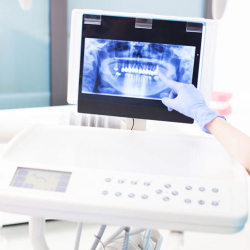 Clínica dental El Pilar tratamientos cirugía oral