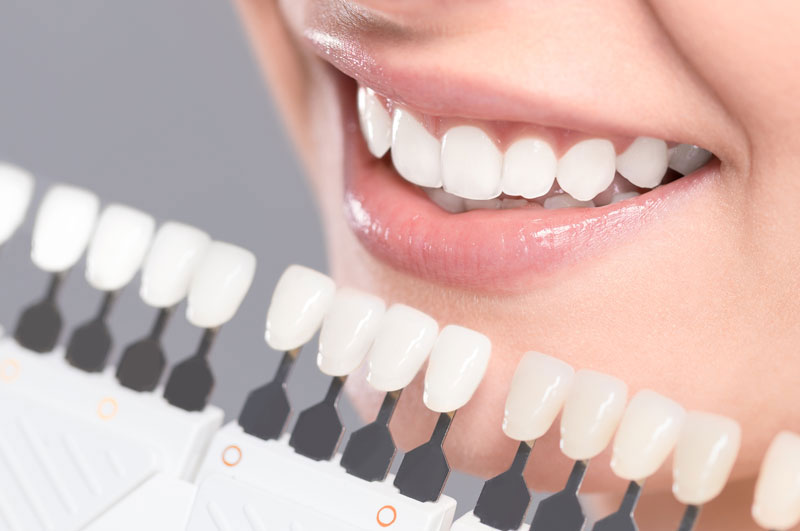 Clínica dental El Pilar tratamientos endodoncia