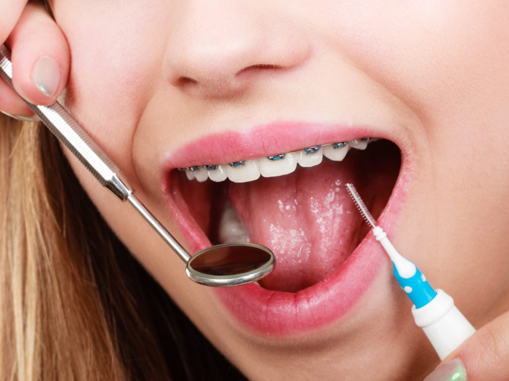 higiene bucodental con ortodoncia