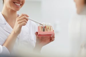 implantes dentales en Madrid