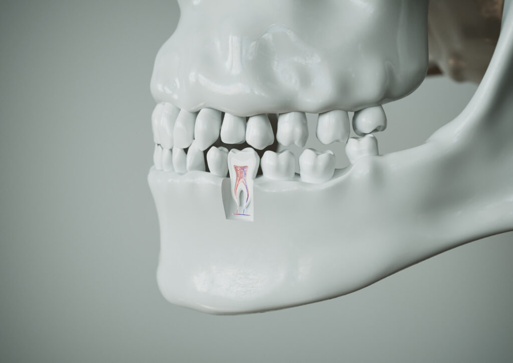 patologías del hueso alveolar