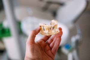 osteointegración
