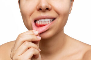 enfermedad periodontal